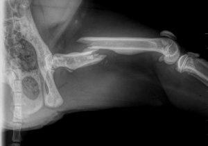 fracture-femur-chat